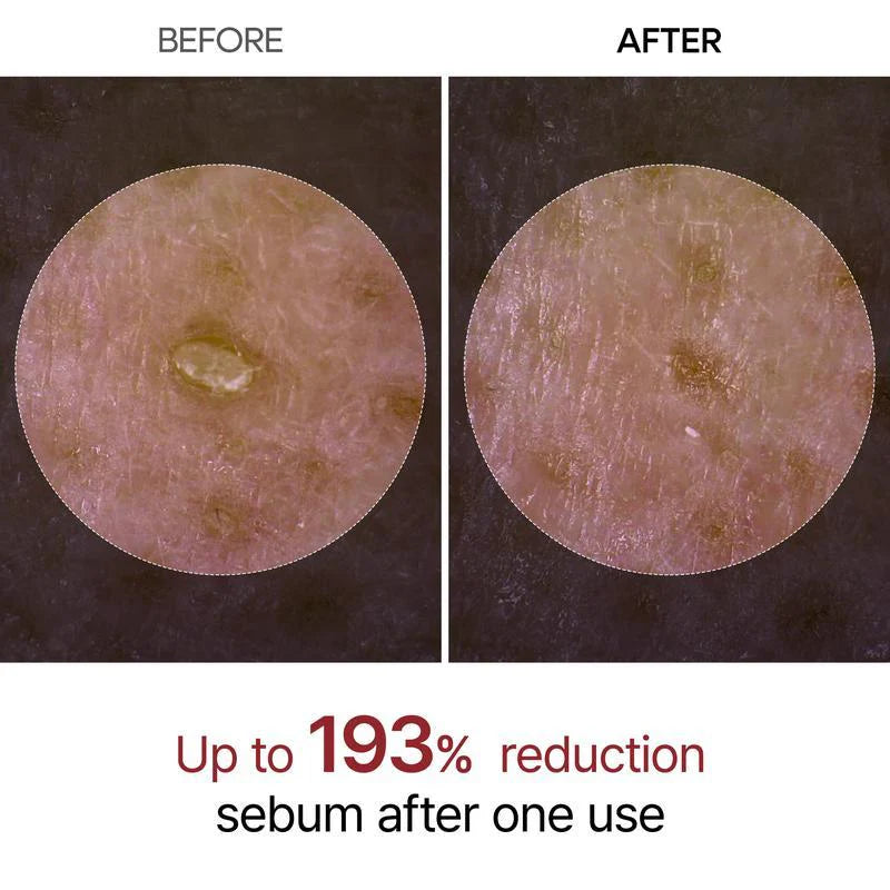 Misspone™ Dermo-Expert Authoritative Certification! 20-Year Clinically Validated Essence, Unlocks Skin Whitening Code!